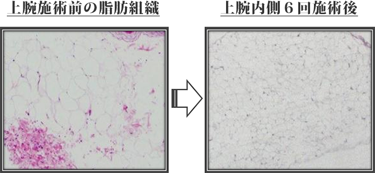 施術前後(1)