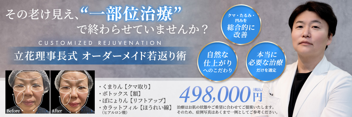クマ・たるみ・凹みを総合的に改善 自然な仕上がりへのこだわり 本当に必要な治療だけを選定 くまりん【クマとり】ボトックス【額】ぼにょりん【リフトアップ】カラットフィル【ほうれい線】(ヒアルロン酸) 1回 498,000円(税込)
