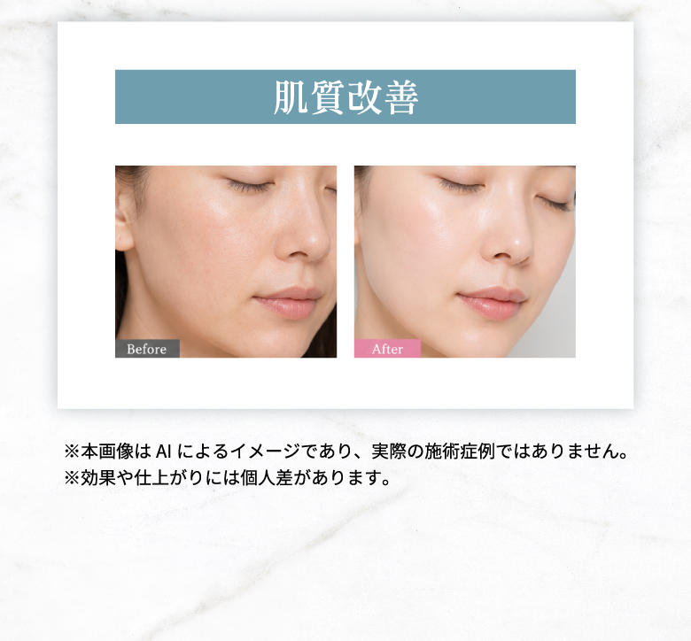 肌質改善