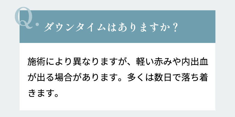 ダウンタイムはありますか？