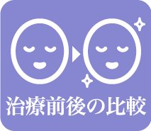 治療前後の比較