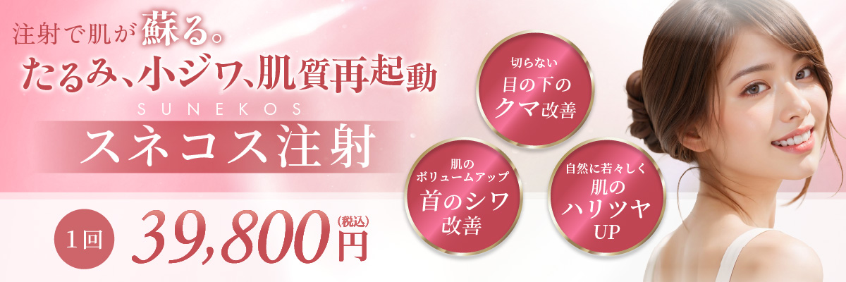 スネコス