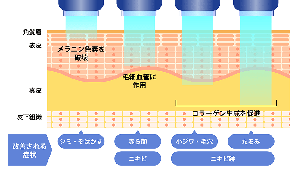 フォトフェイシャル効果を体感までは2～3日。フォトフェイシャルの効果