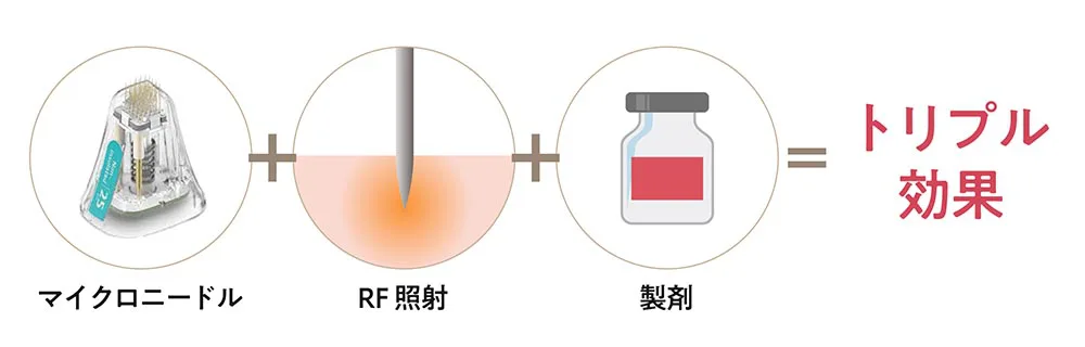 ポテンツァは痛み・ダウンタイムが少ない美肌治療！安全性評価も有