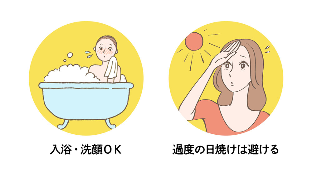 入浴、洗顔は可能、日焼けは避ける