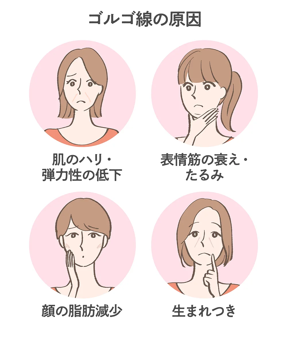 ゴルゴ 線 生まれつき