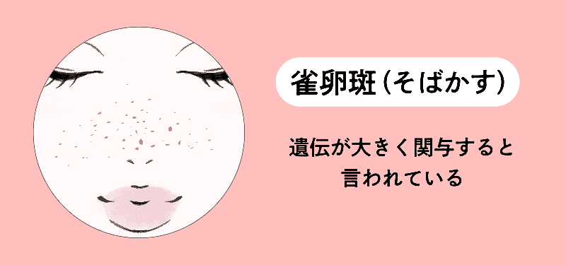雀卵斑（そばかす）