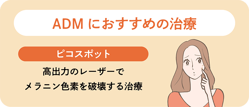 ADM（後天性真皮メラノサイトーシス）