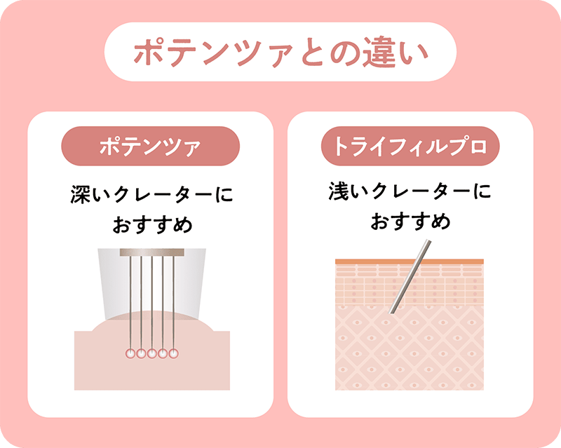 ポテンツァとの違い