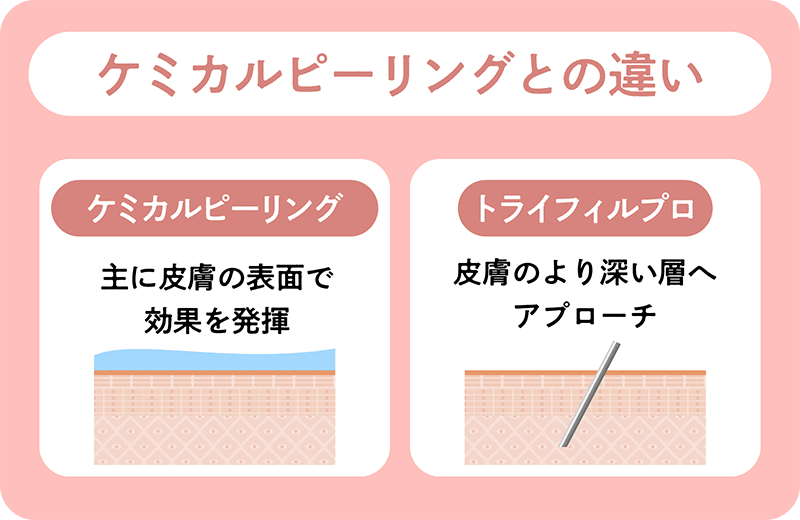 ケミカルピーリングとの違い