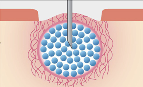 CO2ガスを再度注入