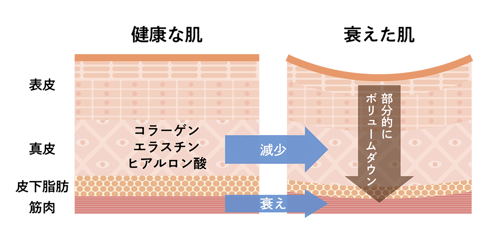 肌のハリがなくなる原因はさまざま